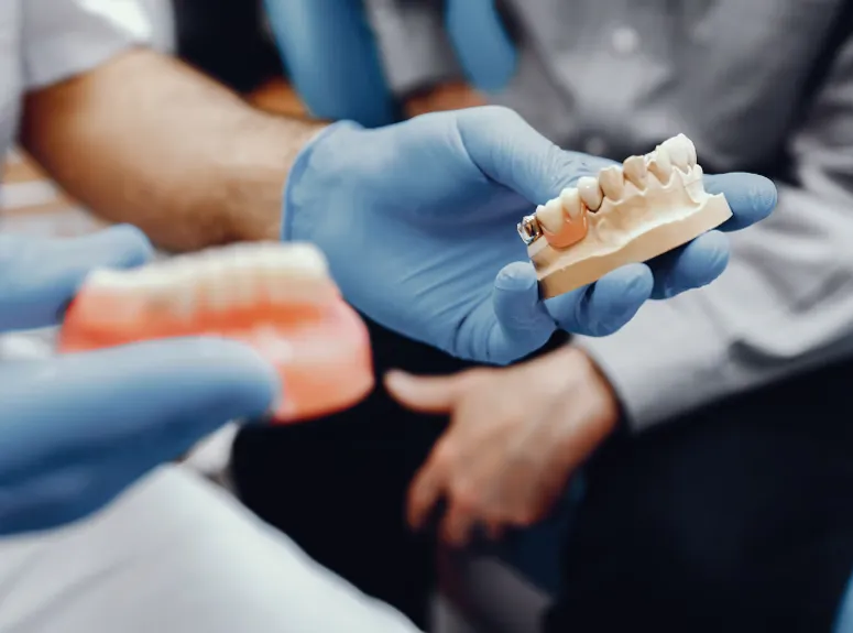 Dental Prosthesis