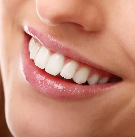 what-is-smile-design-03